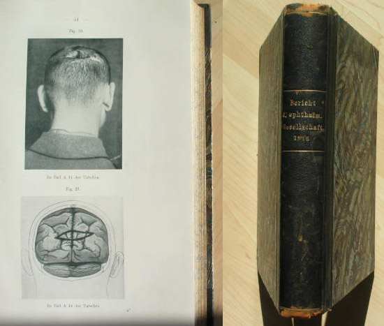 ophtalmologie1916.jpg