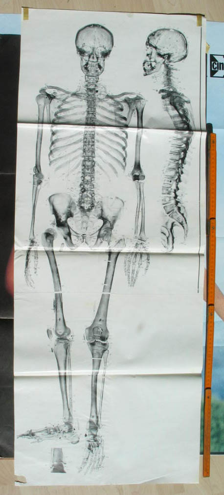 skelett-poster.jpg